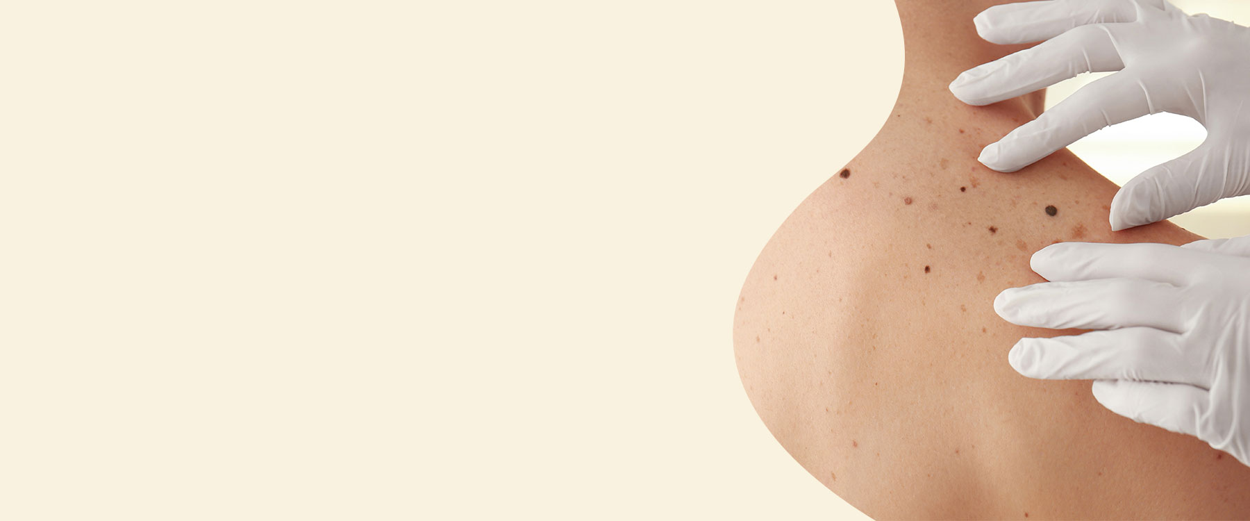Capital Plastic Surgery, specialist plastic surgeon. General skin cancer surgery. Includes melanoma, basal cell carcinoma, squamous cell carcinoma, cysts, benign lumps. Clinics in Lower Hutt, Porirua and Palmerston North. Wellington region.
